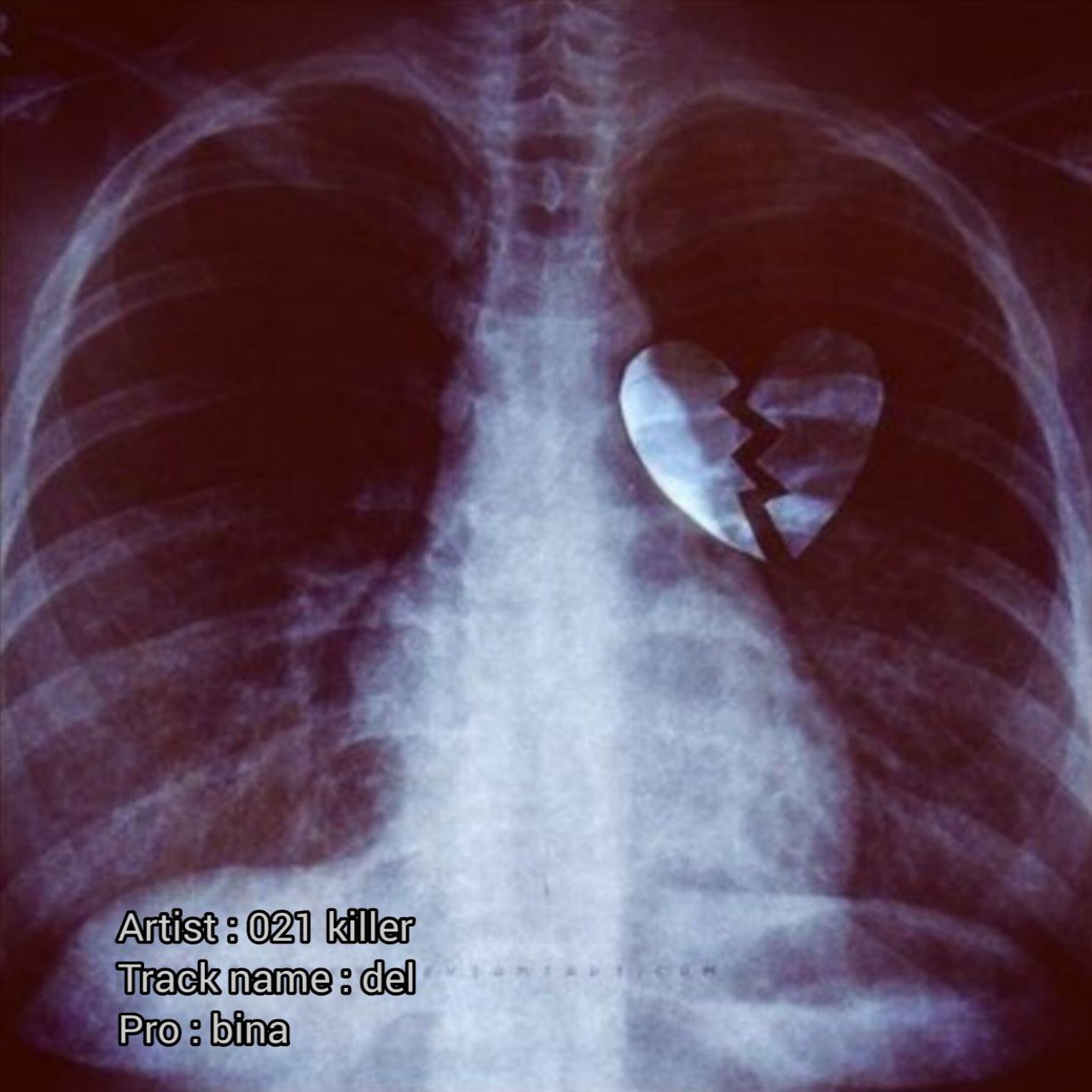 021 Killer – Del